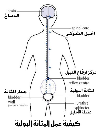 البرونزية